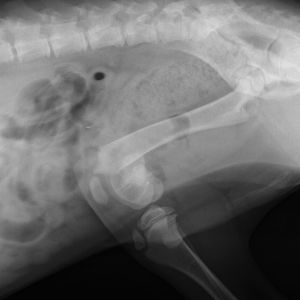Fractura de Femur Fractura de Femur